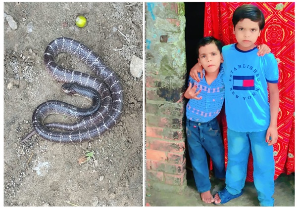 snake bite