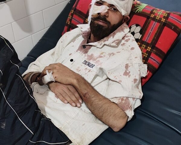 ਅੰਨ੍ਹਾ ਤਸ਼ੱਦਦ