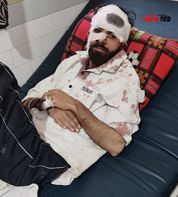 ਅੰਨ੍ਹਾ ਤਸ਼ੱਦਦ