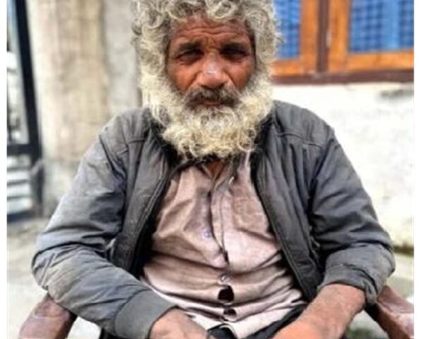 ਹੰਸਾ ਸਿਂਘ